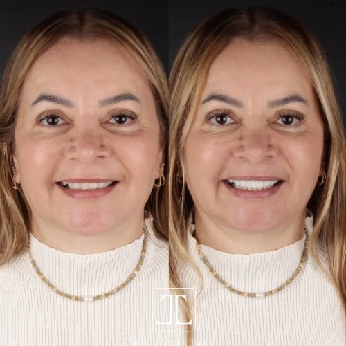 SaveClip.App_474037413_18479298571037304_5114757627222577997_n