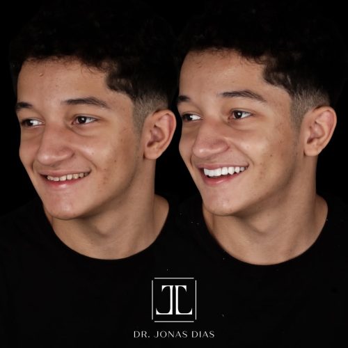 SaveClip.App_475910849_18482618089037304_1965344714099327220_n